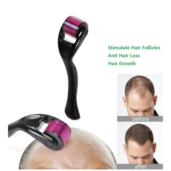 Cosprof 2.5mm Derma Roller, Titanium Micro Needling Roller, Face Care Massage - Picture 5 of 7